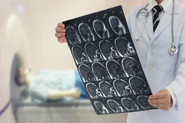 רופא בוחן צילום רנטגן של מוחו של מטופל שעבר שבץ מוחי 